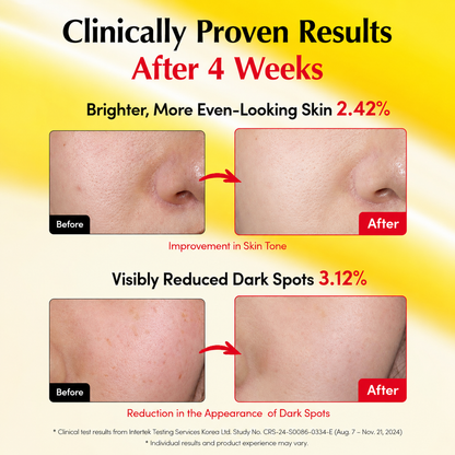 Vitamin C Radiance Duo™